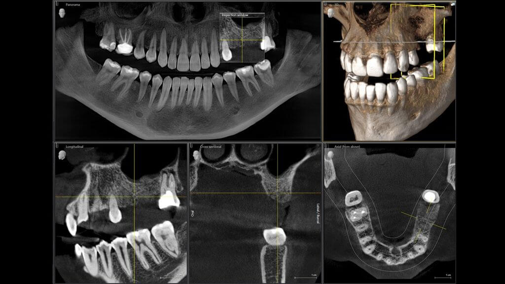 dental tomography CBCT Sopron Hungary